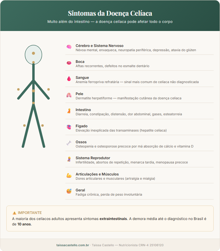 Mapa corporal dos sintomas da doença celíaca: sintomas gastrointestinais e extraintestinais incluindo anemia, fadiga, dermatite herpetiforme, neuropatia e infertilidade